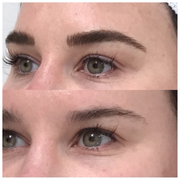 Microblading